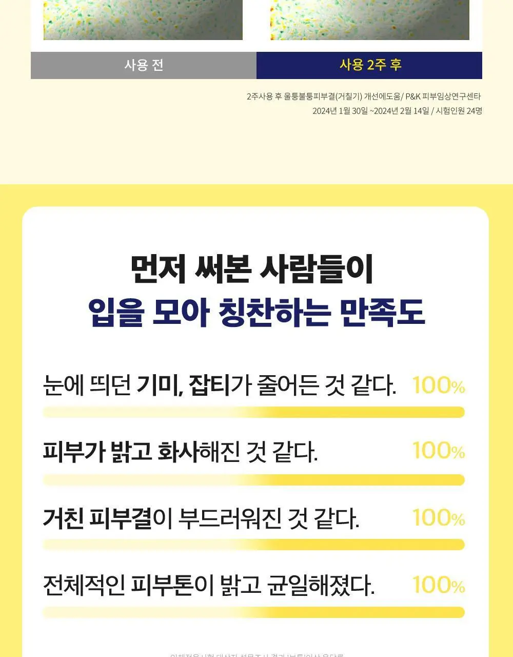 [곽민경PICK/단독기획] CKD 겔마스크 4+1매 (모공탄력/기미잡티) 2종 상세페이지 49
